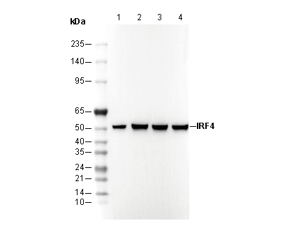 IRF4 Rabbit mAb - F2791 Wb 