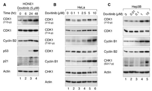 S1018-WB1.gif