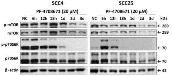 S2163-WB2.gif