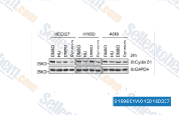 hydroxyurea nsc 32065 dna rna合成 阻害剤